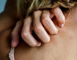 Derma- i trichotillomania (spektrum OCD) – skuteczna praca z pacjentem w podejściu CBT