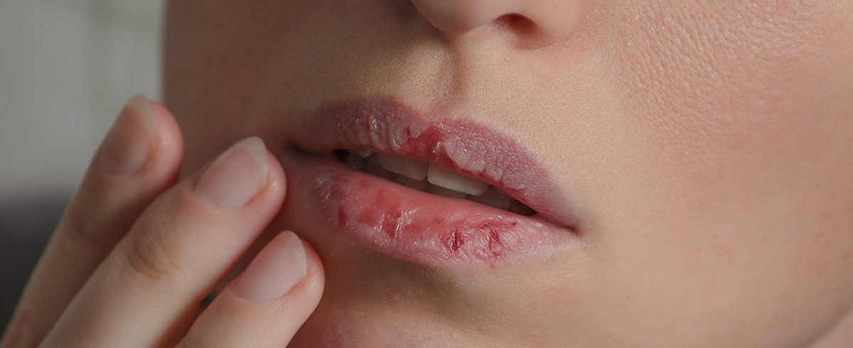 Zaburzenia obsesyjno-kompulsyjne i związane z nimi zaburzenia_-1